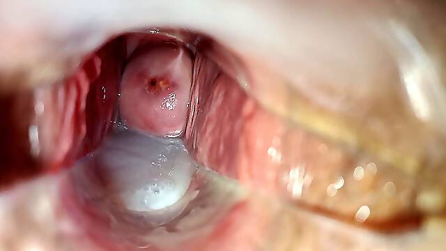 Cum inside cunt close-up speculum